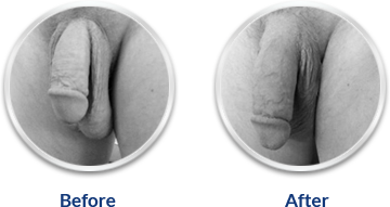 Ultra Power Capsule!