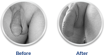 Ultra Power Capsule!